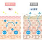 妊娠線クリームの必要性