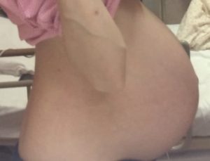 双子妊娠30週のお腹