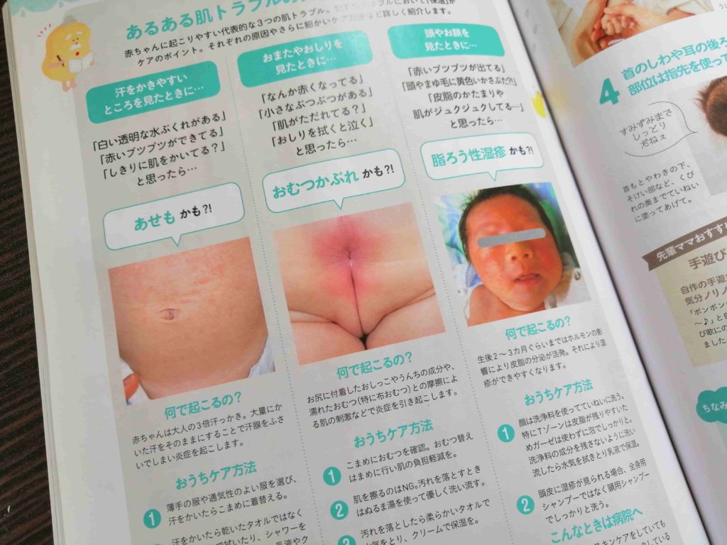 【ゼクシィベビー雑誌】赤ちゃんが生まれたら読む本赤ちゃんのお肌のトラブル